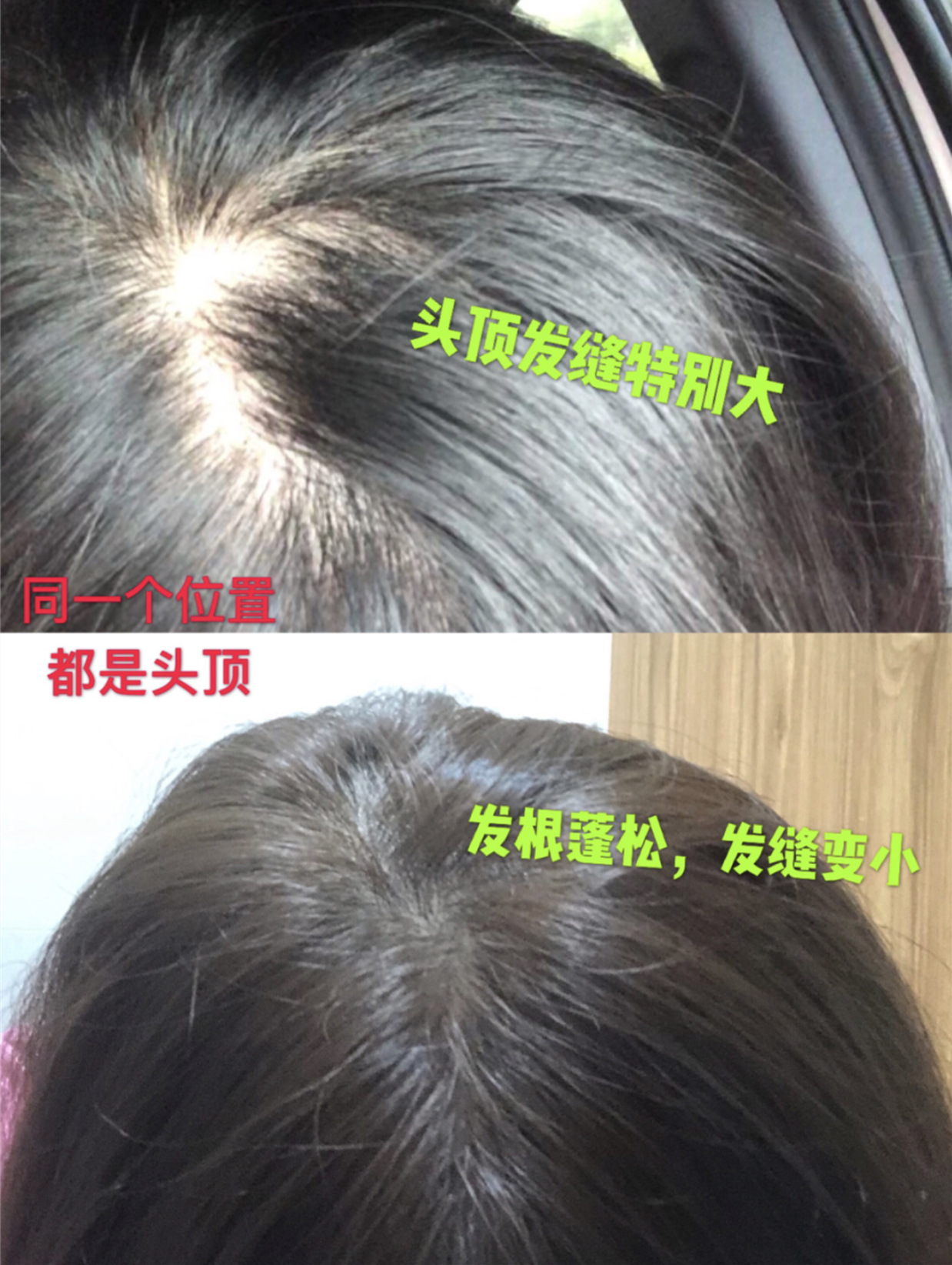 韭菜 我国一“低调”洗发水，因李佳琦分享意外走红，用后头发乌黑浓密