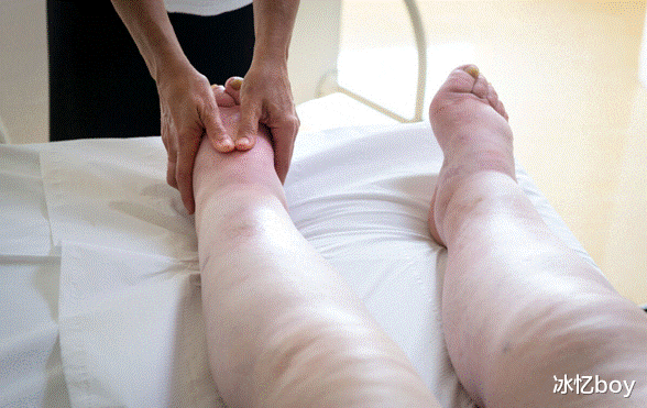 类风湿关节炎|尿酸高不能“拖沓”,身体若出现3种迹象,建议多做“2事”,或有益