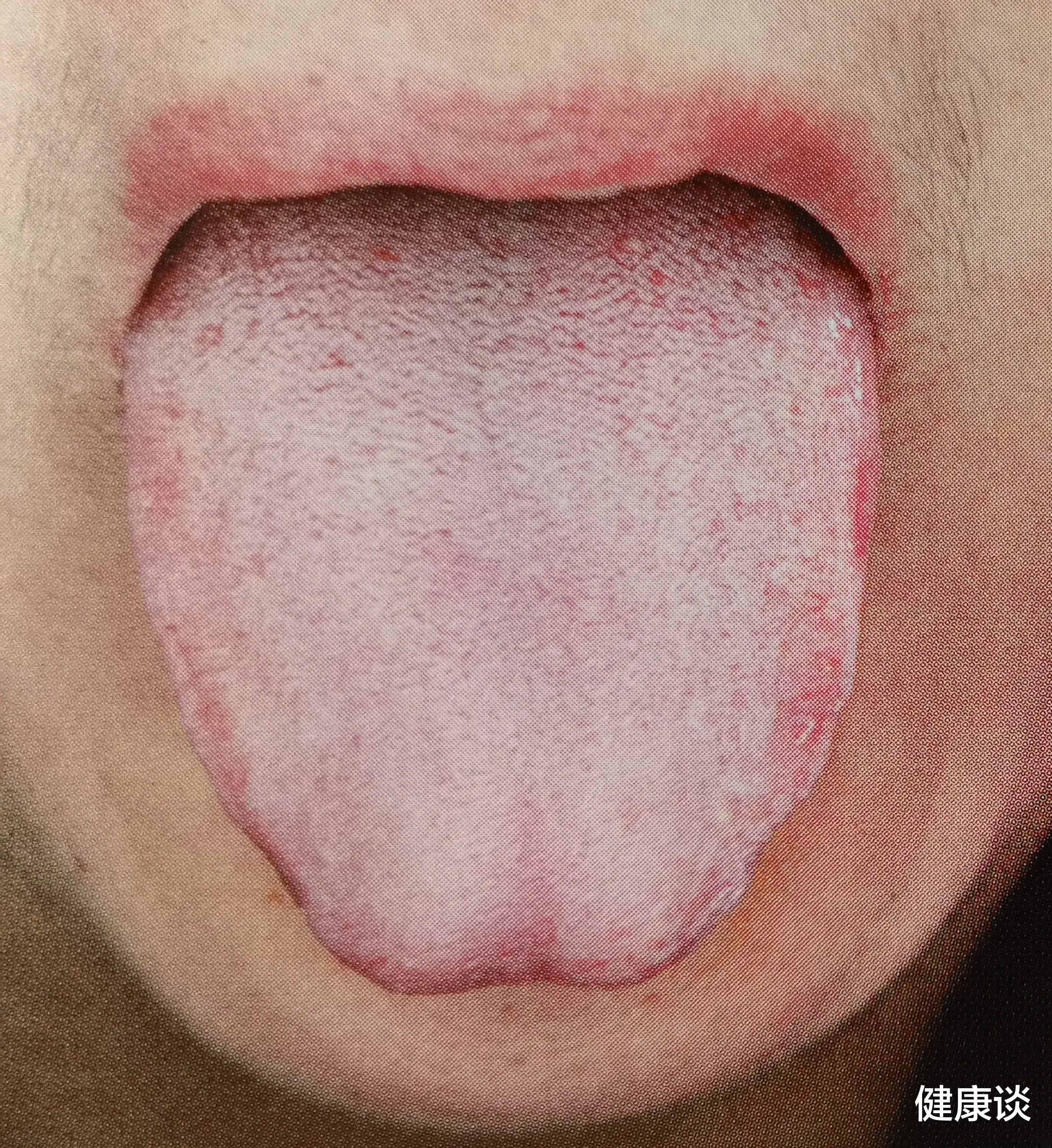 中药|老中医：中医4大虚症的舌象表现及茶饮方法