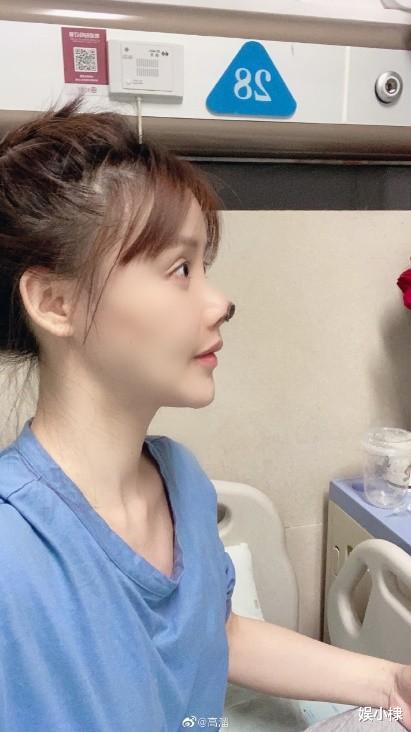 整容|整容失败后的女明星到底有多后悔？看景甜就知道了……