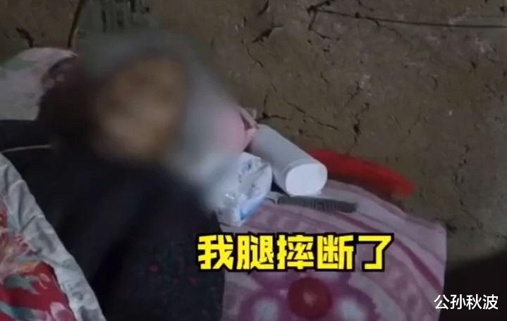 公孙秋波 心痛！山东8旬老母摔断腿，7个儿女放弃治疗：儿女们怕花钱