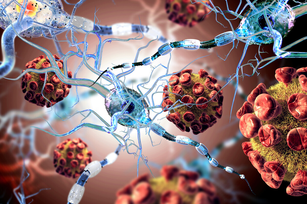 新型冠状肺炎 新冠病毒为何频繁变异？为什么会出现超级传播者？