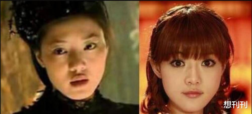 整形|明星的N种“假下巴”，尖到戳死人，翘成老巫婆，一个比一个怪异