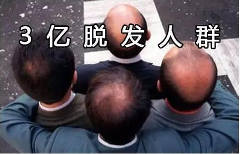 孕妇|脱发到露头皮，防脱生发硬核干货来袭！