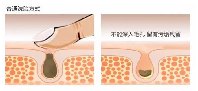 美白 21岁女大学生长期浓妆，素颜时满脸黄褐斑，医生：皮肤太伤了