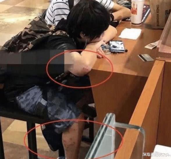 温兆宇|两岁出道演戏，片酬被父母花光，如今皮肤溃烂却无人理睬