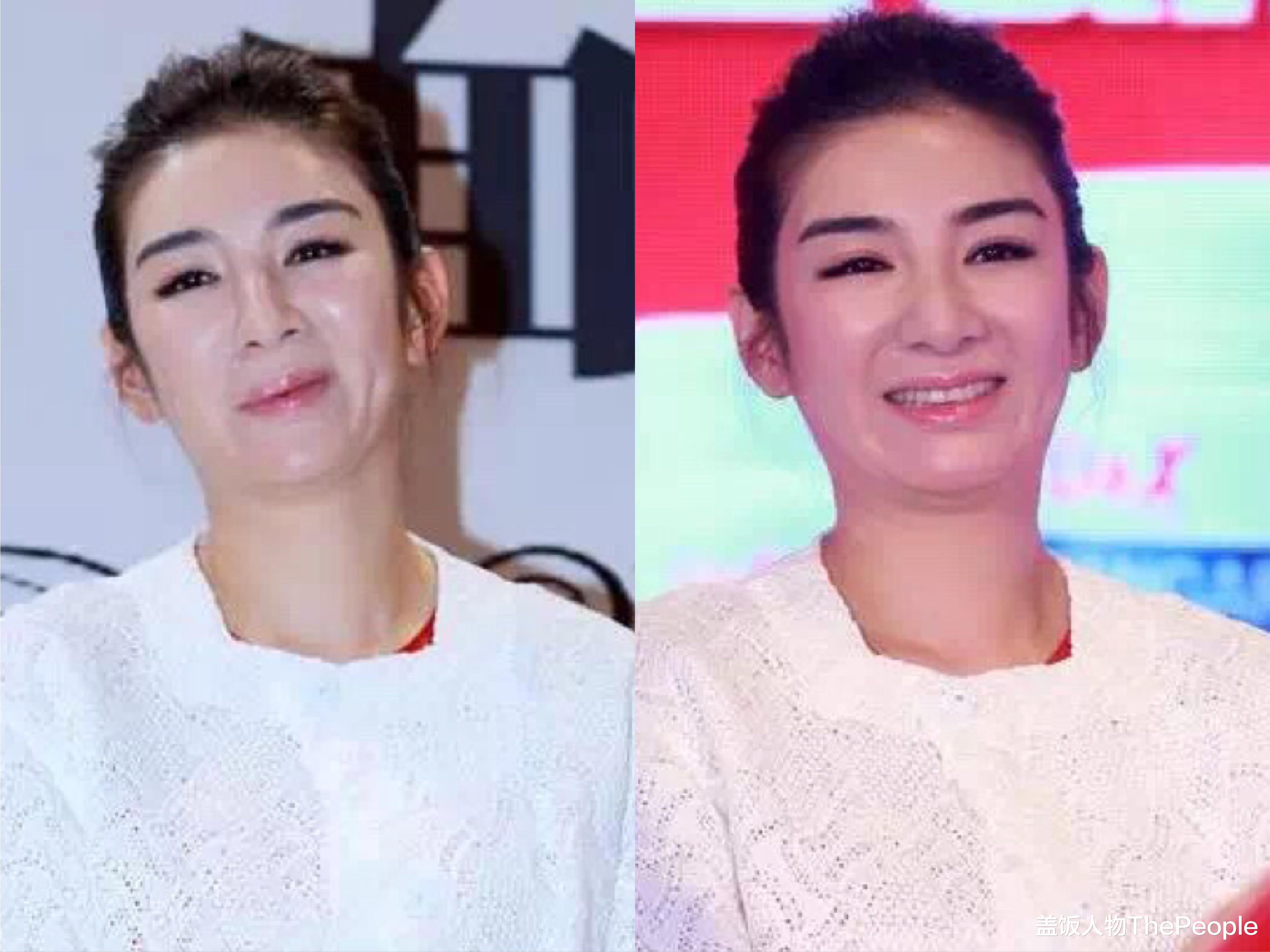 张萌|嘴歪、脸肿、表情僵硬，让实力派女星们陷入“中年危机”，太可惜