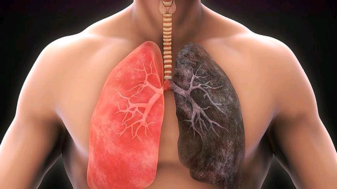 |经常散步对肺部有好处吗？提醒：肺喜三件事，想要肺好，建议多做