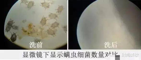 时尚美妆|刘亦菲也曾“跌下神坛”，只因后背长痘，长得好皮肤差是啥体验？