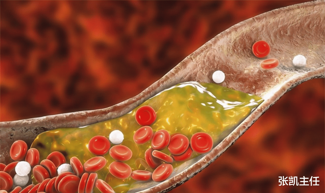 张凯主任|几块钱一瓶的谷维素，都有哪些神奇功效？预防高血脂，抗心律失常