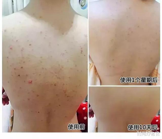 许路儿|44岁许路儿活成23岁少女模样，小S直呼“不老女神”，护肤就靠2点