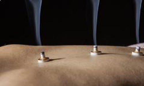 便秘|半身不遂、口歪眼斜怎么治?中医灸药并用显奇效