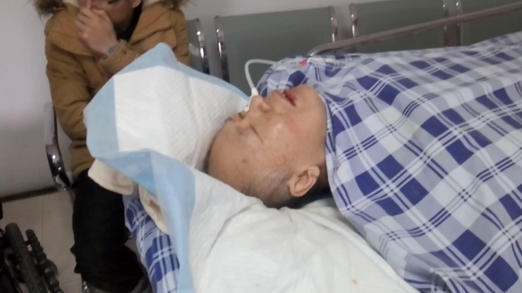 胆固醇|“胆固醇大户”被找到了，蛋黄不在榜，不想血管堵塞，三物要少吃