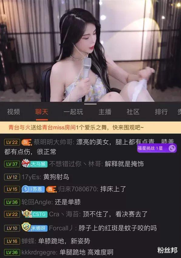 |苏恩腿上淤青有伤，被追问造成的原因，解释喝酒摔倒粉丝秒懂