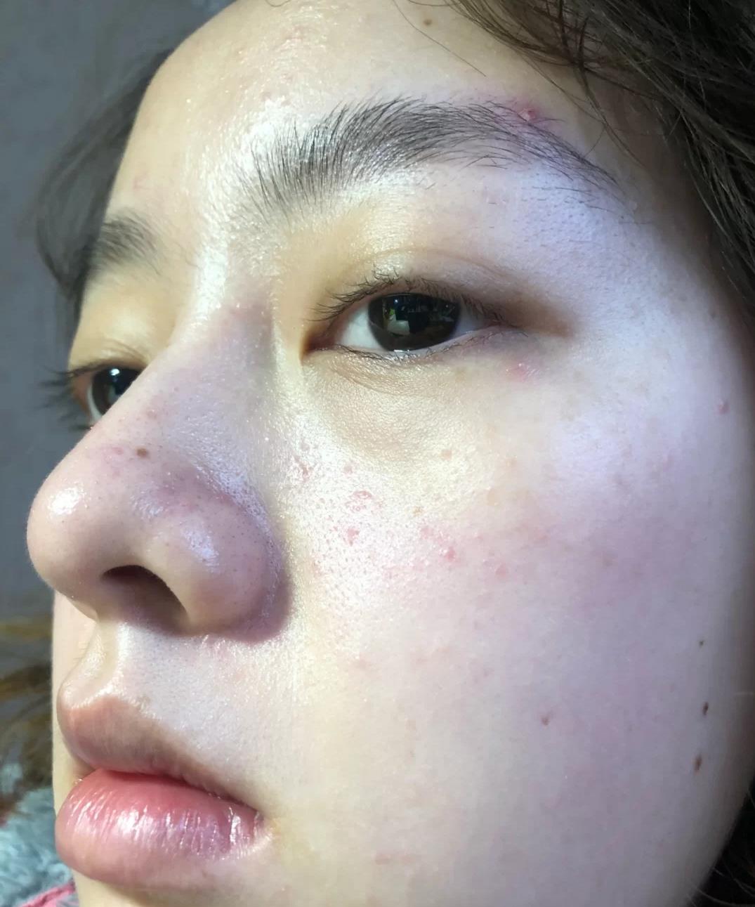 美容|皮肤白也不好？脸上的几个缺点很明显，你有吗