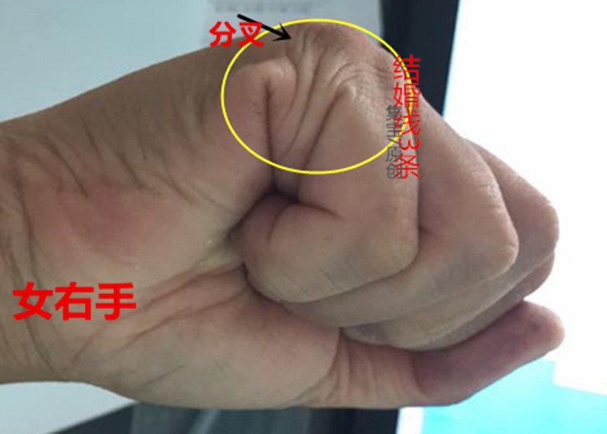 诚然情感之事|手相：两线相交，婚姻谨防“亮红灯”