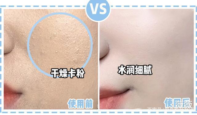 爽肤水 继“佰草集”后，又一“爽肤水”备受“宠爱”，逛街遇到别错过