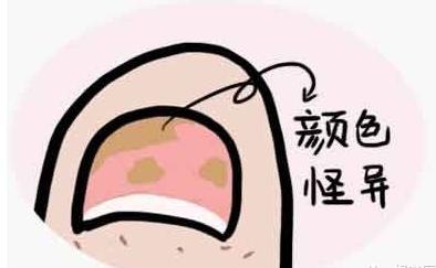 健康养生冲我作|“灰指甲”就一定是灰色的吗？今天和大家聊一聊灰指甲
