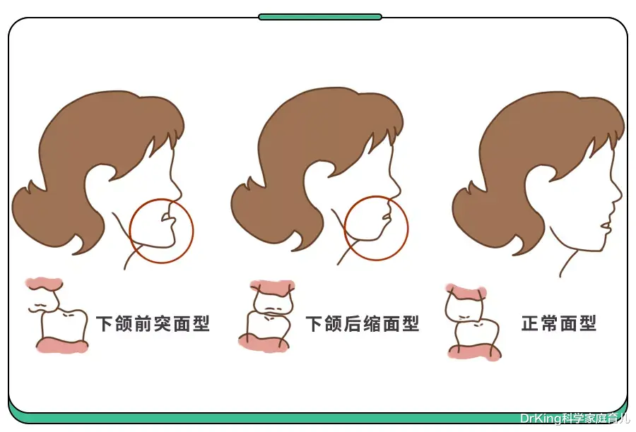 DrKing科学家庭育儿|频繁咬指甲致娃“毁容”!宝妈群热议4大戒断绝招,赶紧试!
