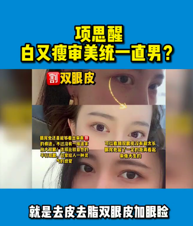 项思醒|项思醒整容前后差异大！UP主分析其做了10个项目，全脸基本都动过