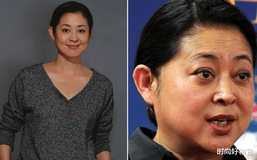 时尚好物官|南昌女子为抗老，注射20多针“除皱针”，脸部“凹”到笑不出来