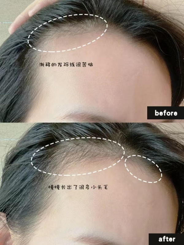 洗发水 2类被“曝光”的黑名单洗发水，很多女生都用过，我看见都会绕着走