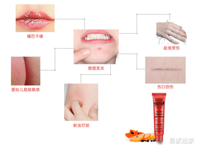 慕紫菇凉|生理期为何会爆痘？1个知识点+4大好货，轻松解决痘痘问题