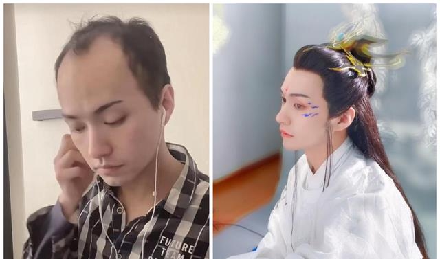 明星|“秃顶网红”凭高颜值出圈，与真明星同框后，网友：滤镜碎了
