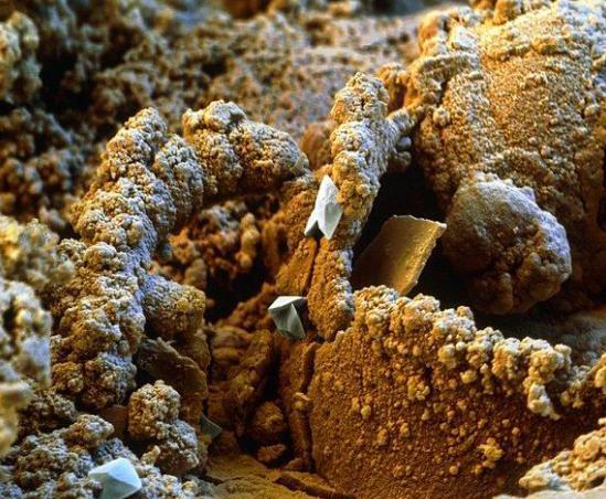 显微镜 电子显微镜下的围观世界, 让人称奇