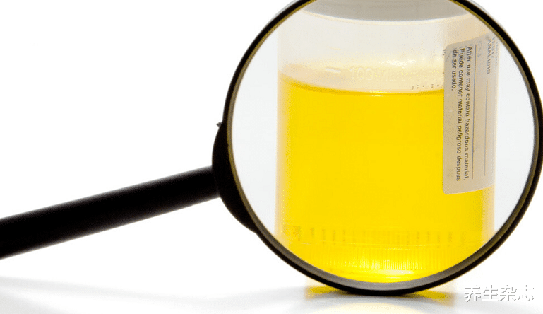 肝硬化|25岁小伙一天大便5次，确诊肝硬化，医生：排泄3异常，趁早检查