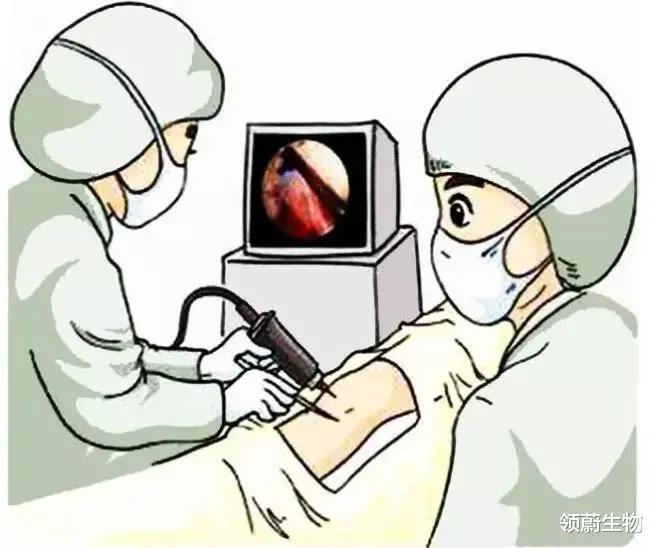 骨关节炎|你的膝盖还好吗?干细胞或将成为膝骨关节炎最有效的调节方式!