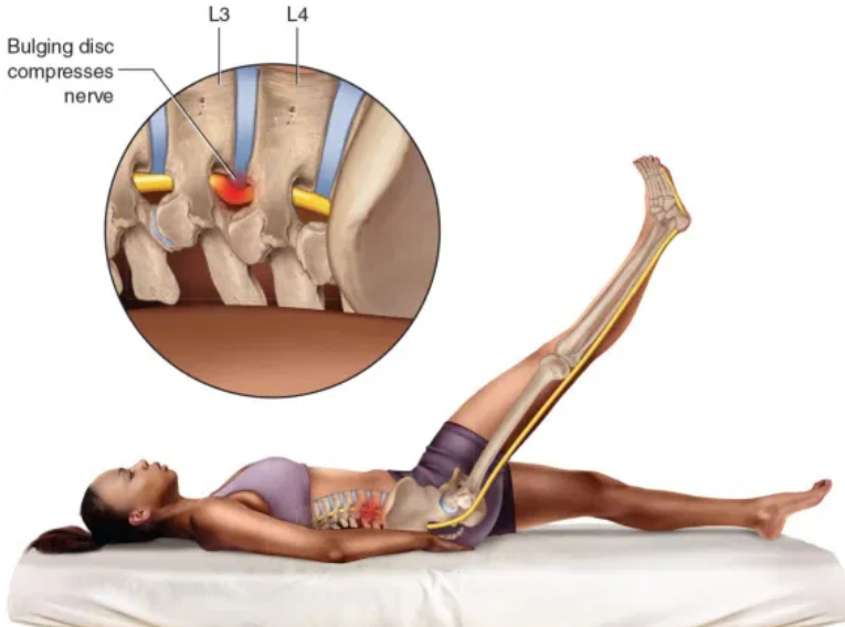 疾病|老年人腿抽筋，是缺钙还是着凉了？小腿痉挛，警惕三种疾病