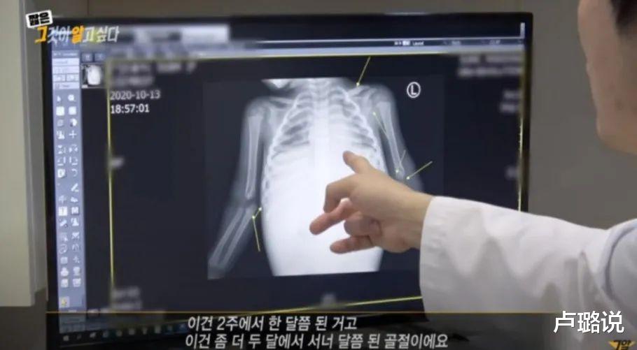 卢璐说|16个月女婴被虐打致死,800多个视频揭露了养父母的人面兽心