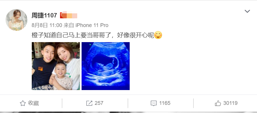 菁妈育儿|奥运冠军邹凯妻子周捷晒二胎B超，进入孕中期，胎宝成长有啥变化