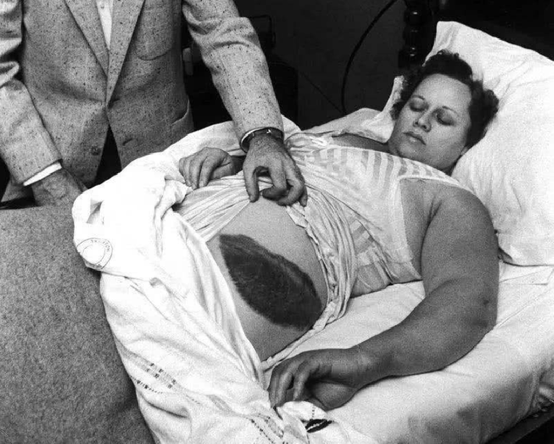 陨石 她被陨石击中，将陨石“据为己有”，却被贪婪毁了一切