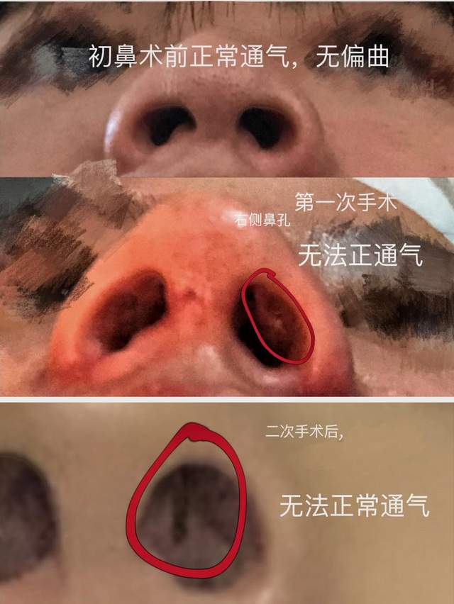 李家人翻译 美容事故纠纷不断却依旧无人管！院方：随便起诉！