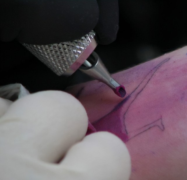 免疫系统|文身对身体有害吗？美国宝妈花150美元文身，结果疣顺着纹路疯长