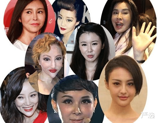 严选|周迅无法面对衰老在家哭，医美抗衰老风险大，如何正确抗衰老？