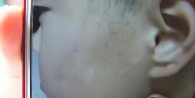 亞洲播報一姐 安徽一老師疑醉酒后虐待學生，拿熱水潑學生，相關部門已介入