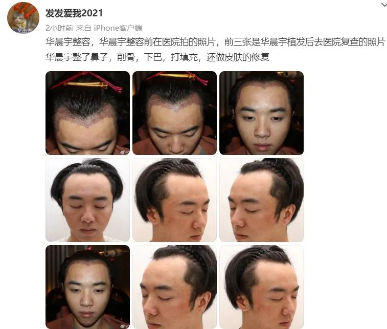 华晨宇|华晨宇整容、出轨、打胎实锤了？