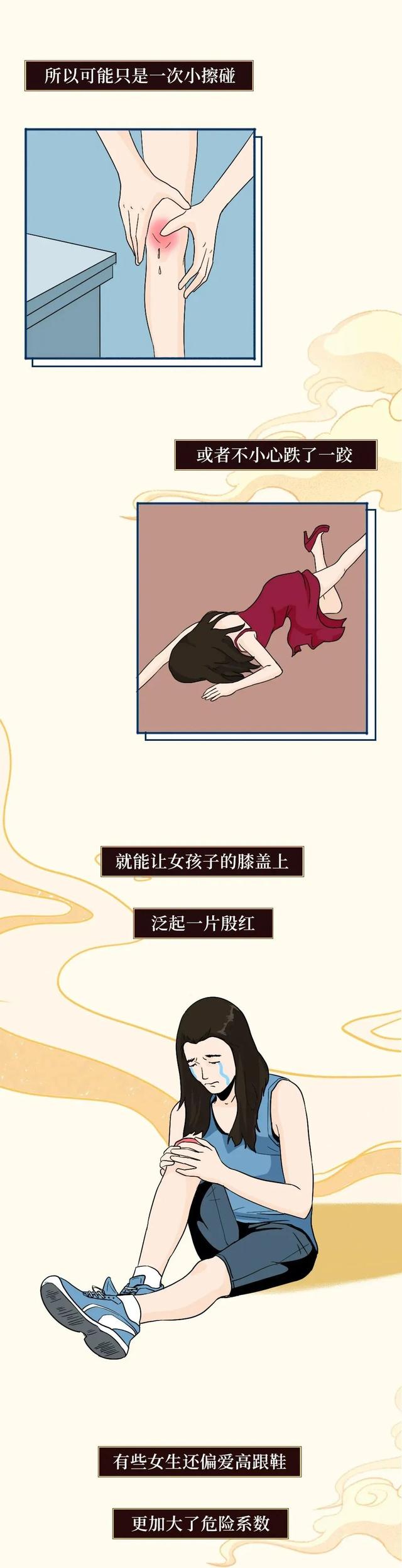 90后宝妈经验|女生膝盖上的淤青到底是怎么来的？从科学的角度告诉你真实原因