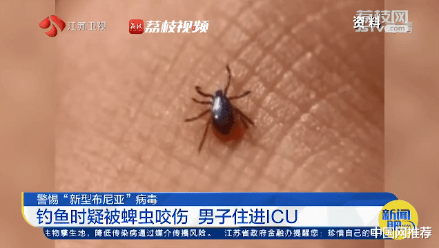 重症监护室|警惕！男子钓鱼时被它咬了，回来后发热咳血，一度严重到住进ICU