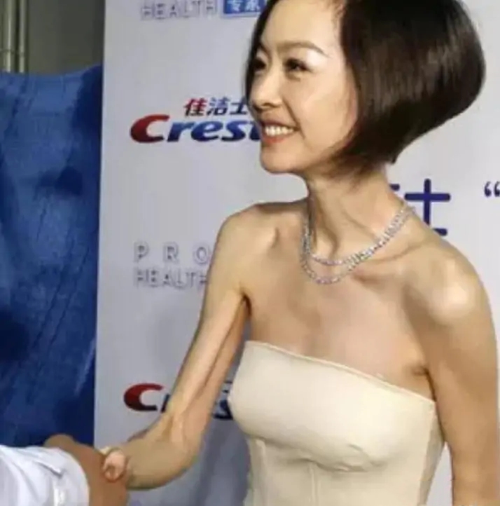 杨幂|女明星真可怜!为了减肥从来没有吃饱过,瘦成排骨就漂亮吗?