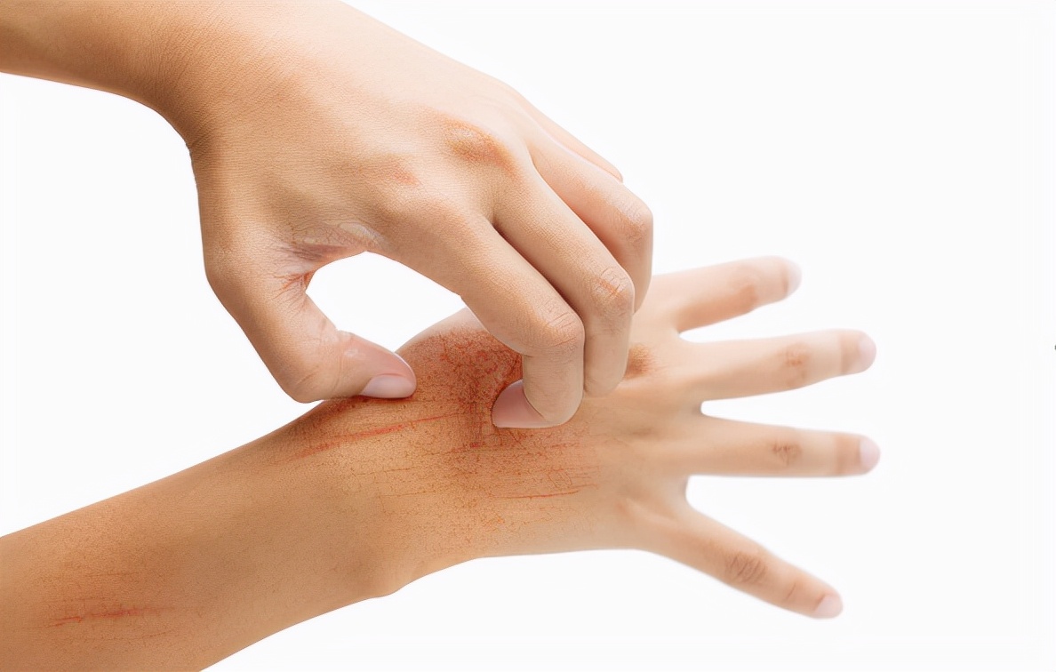 阴虚火旺|“天然胰岛素”被发现,洋葱靠边站,若你爱吃,血糖“蹭蹭”下降