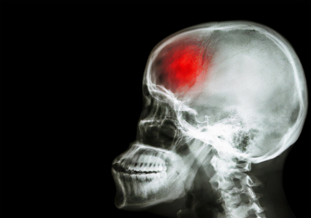 医线天|为何“高血脂”越来越多?提醒:4件事尽早远离,保护血管