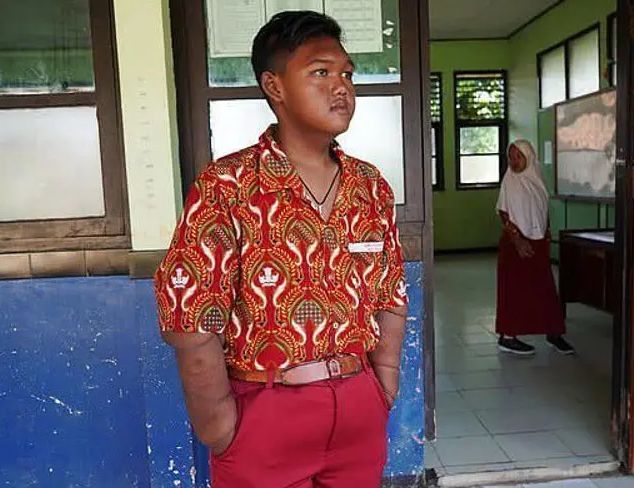 |那个400斤世界最胖小孩，你还记得吗？如今减肥成功，帅到认不出