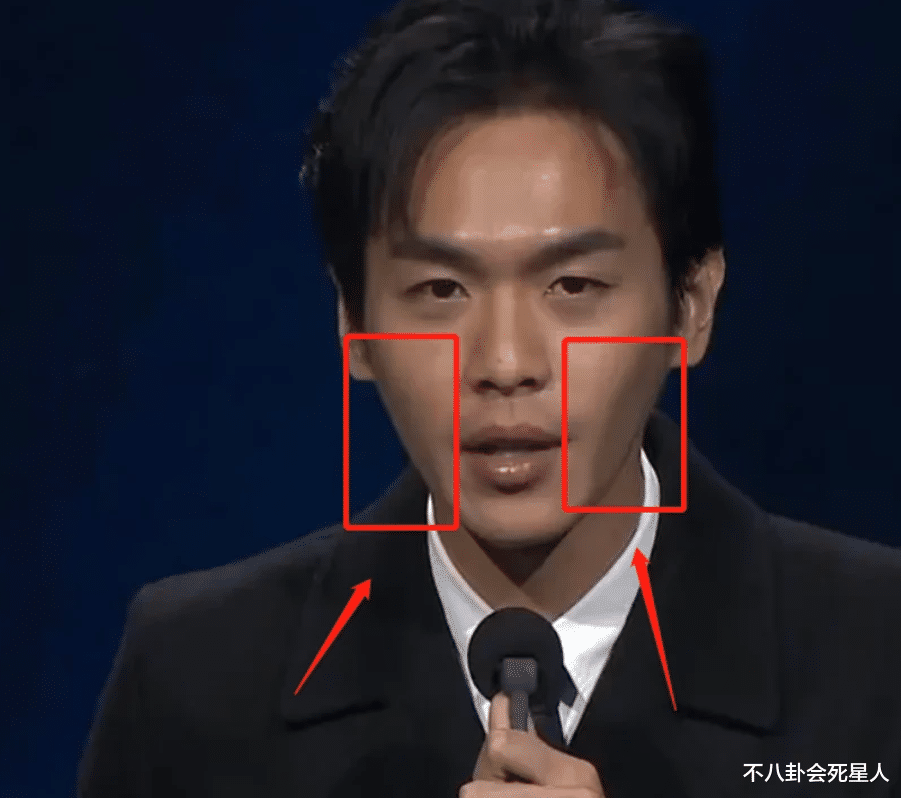 金晨|红毯上的7位“大头娃娃”，肩窄腰细筷子腿，瘦得过分真不好看