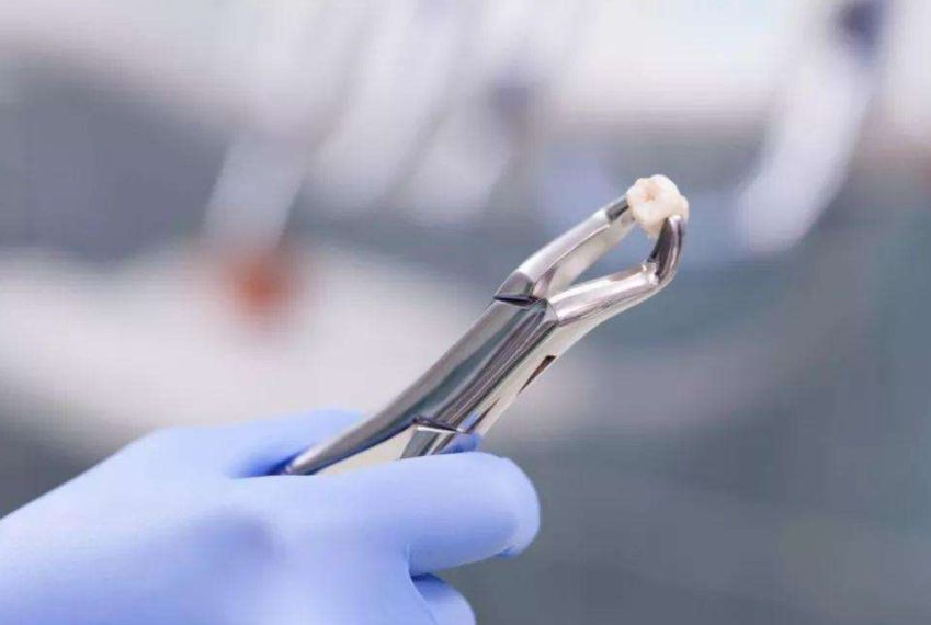 急诊室老苗|为啥拔牙必须上午去?医生的讲究不是没道理,保护孩子牙齿很重要