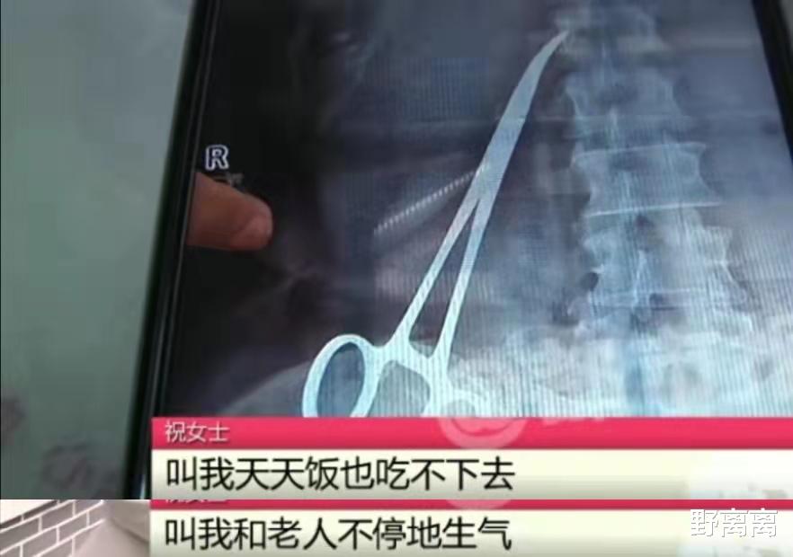 野离离|河南：女子小产后发现腹中竟藏止血钳，但让她痛苦的却不止是腰疼