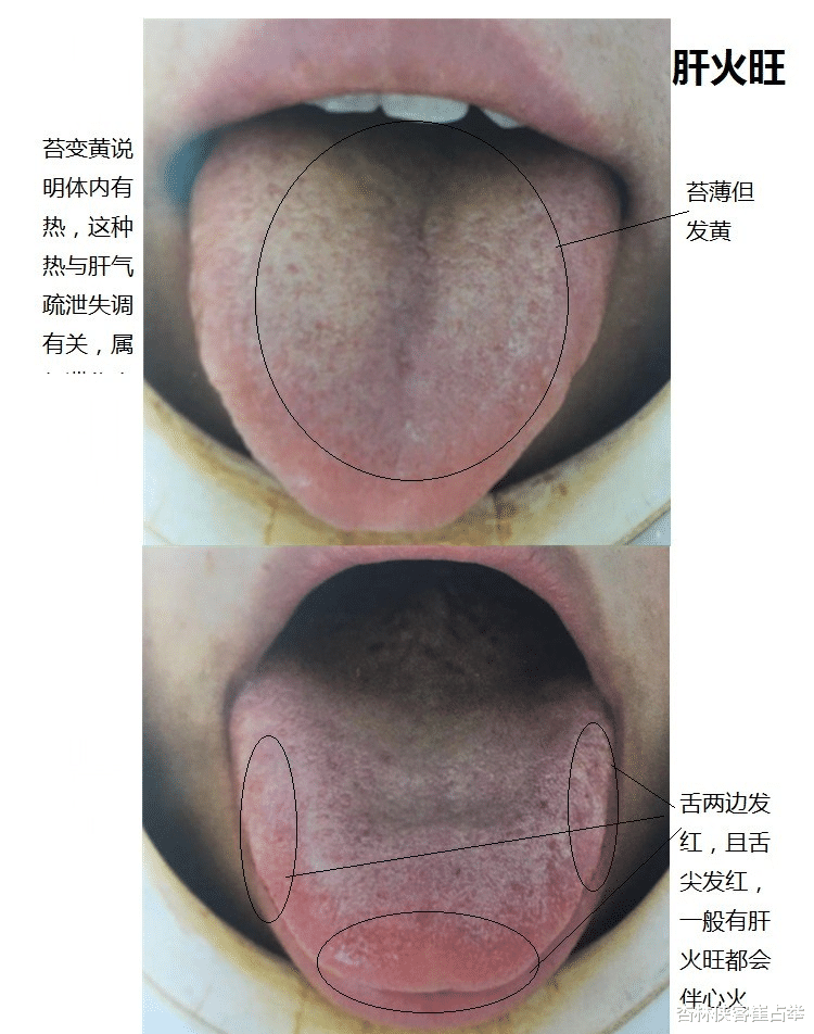 健脾祛湿|心肝火旺怎么调，送你一个方子，疏肝理气，滋阴清热，健脾祛湿